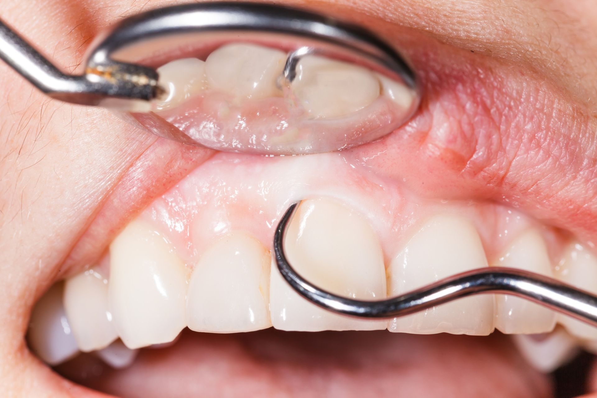 Dental-examination