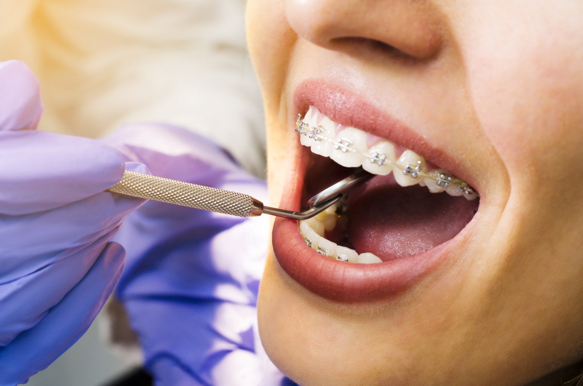 Orthodontic treatment
