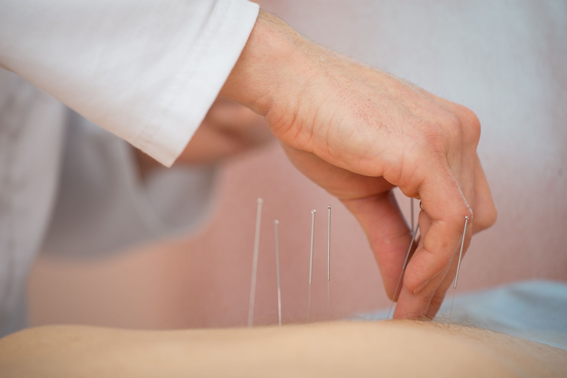 Acupuncture Treatments | Tucson, AZ | OA