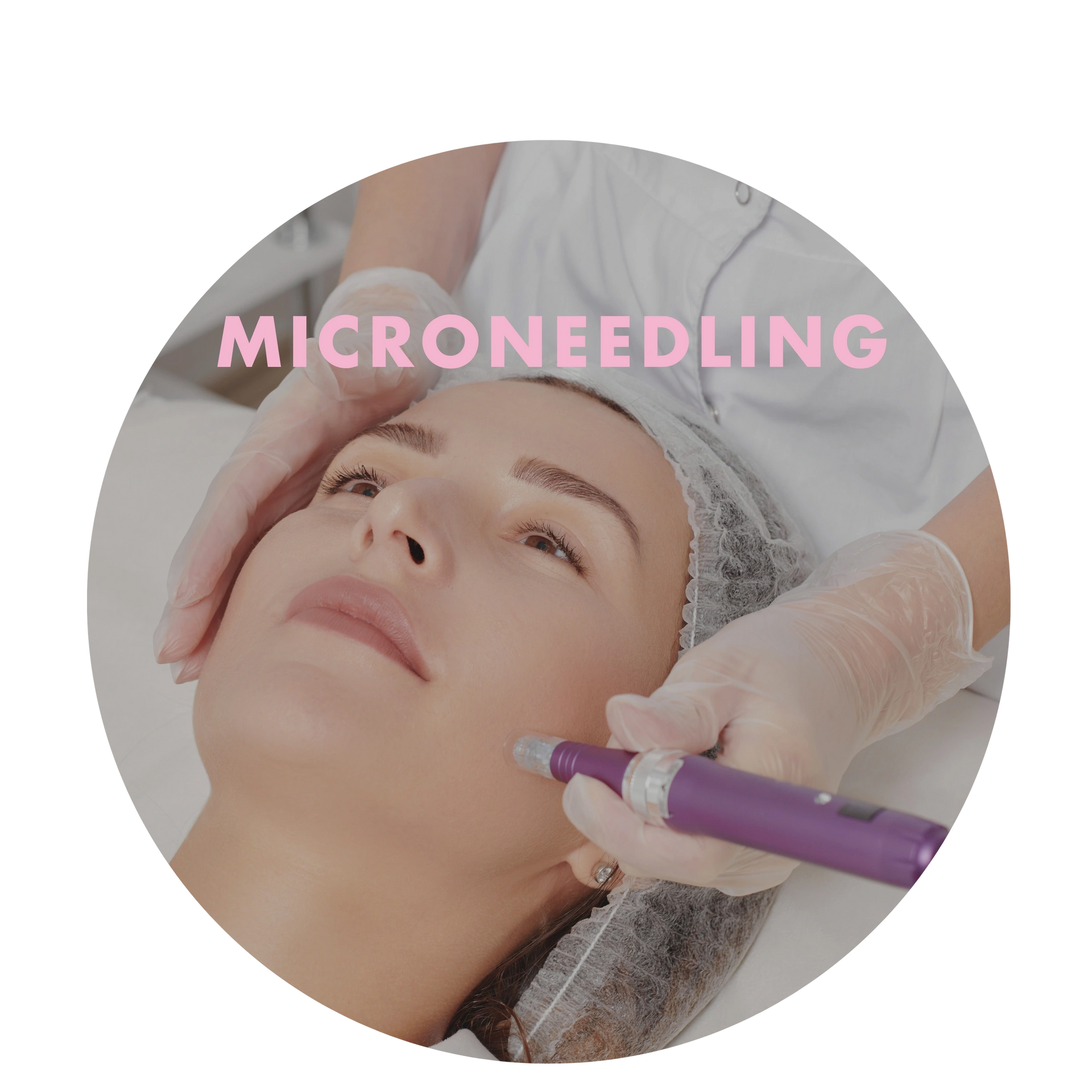 A woman is getting a microneedling treatment on her face