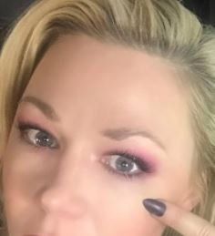 diy botox