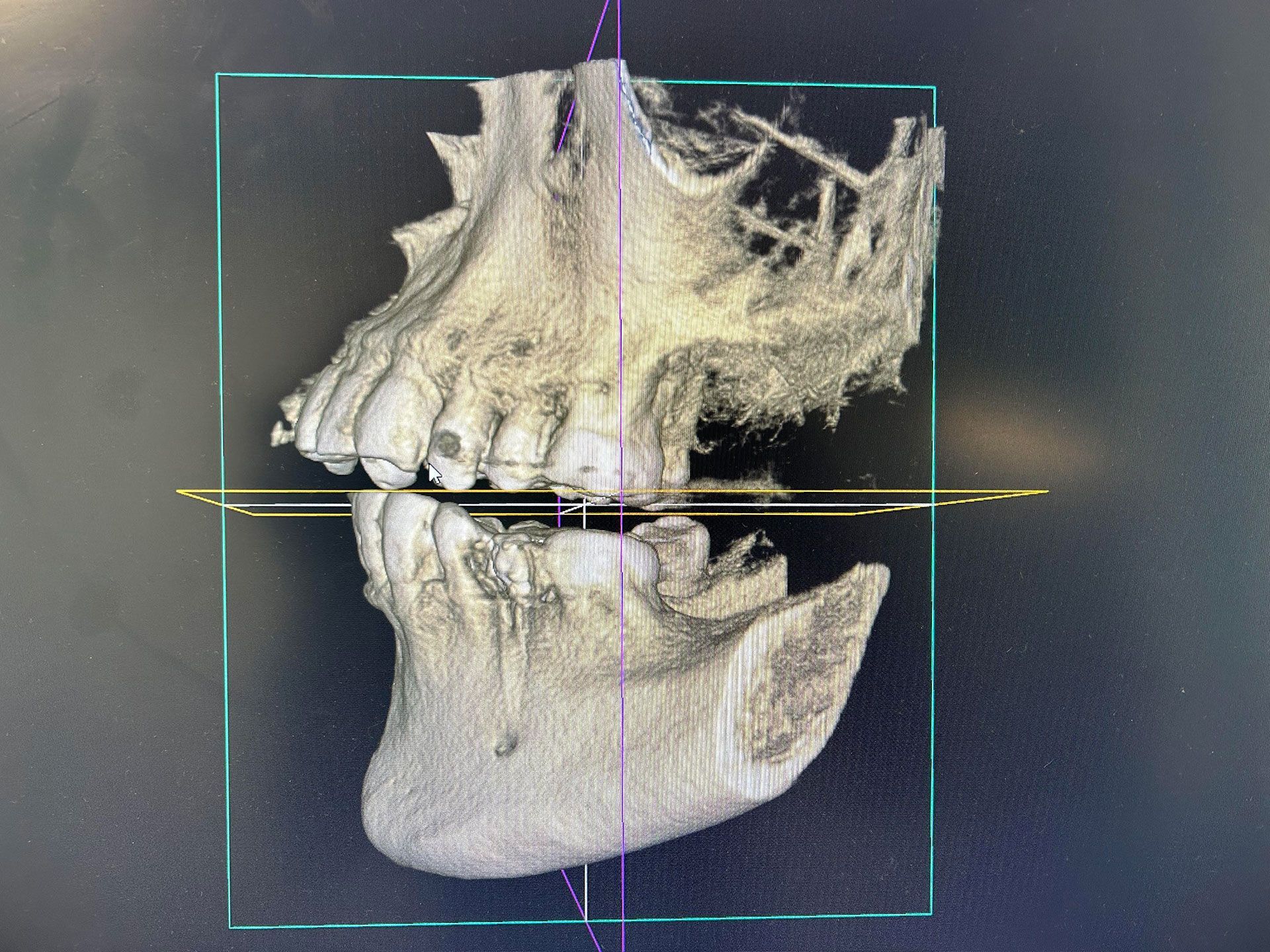 3D