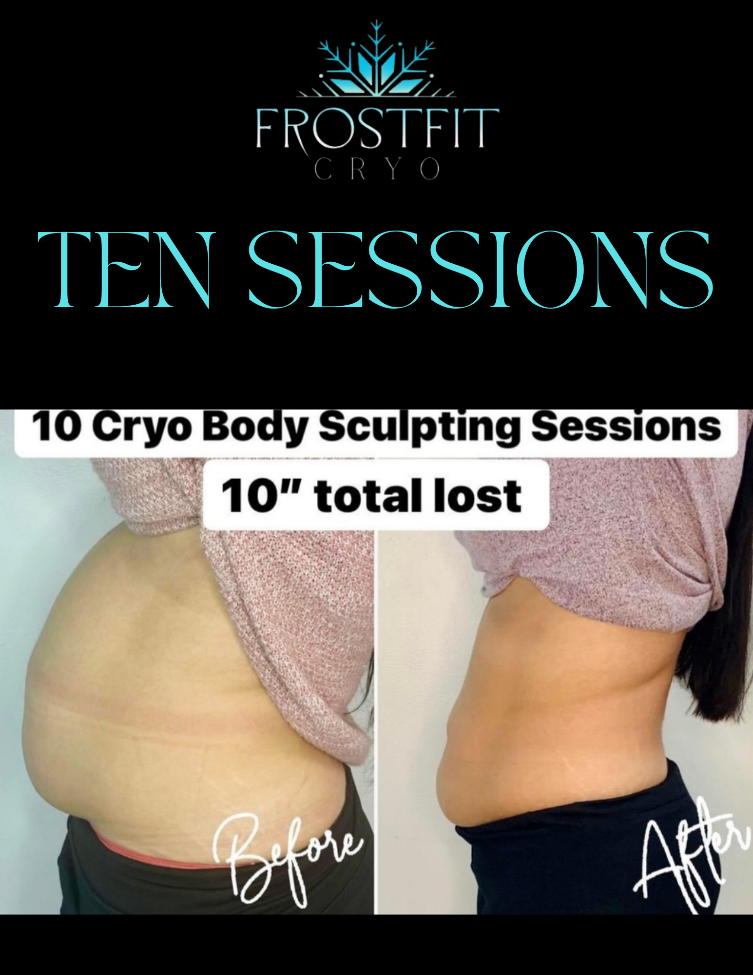 Side-by-side photos comparing a person's abdomen before and after 10 cryo body sculpting sessions; 10 inches total lost.