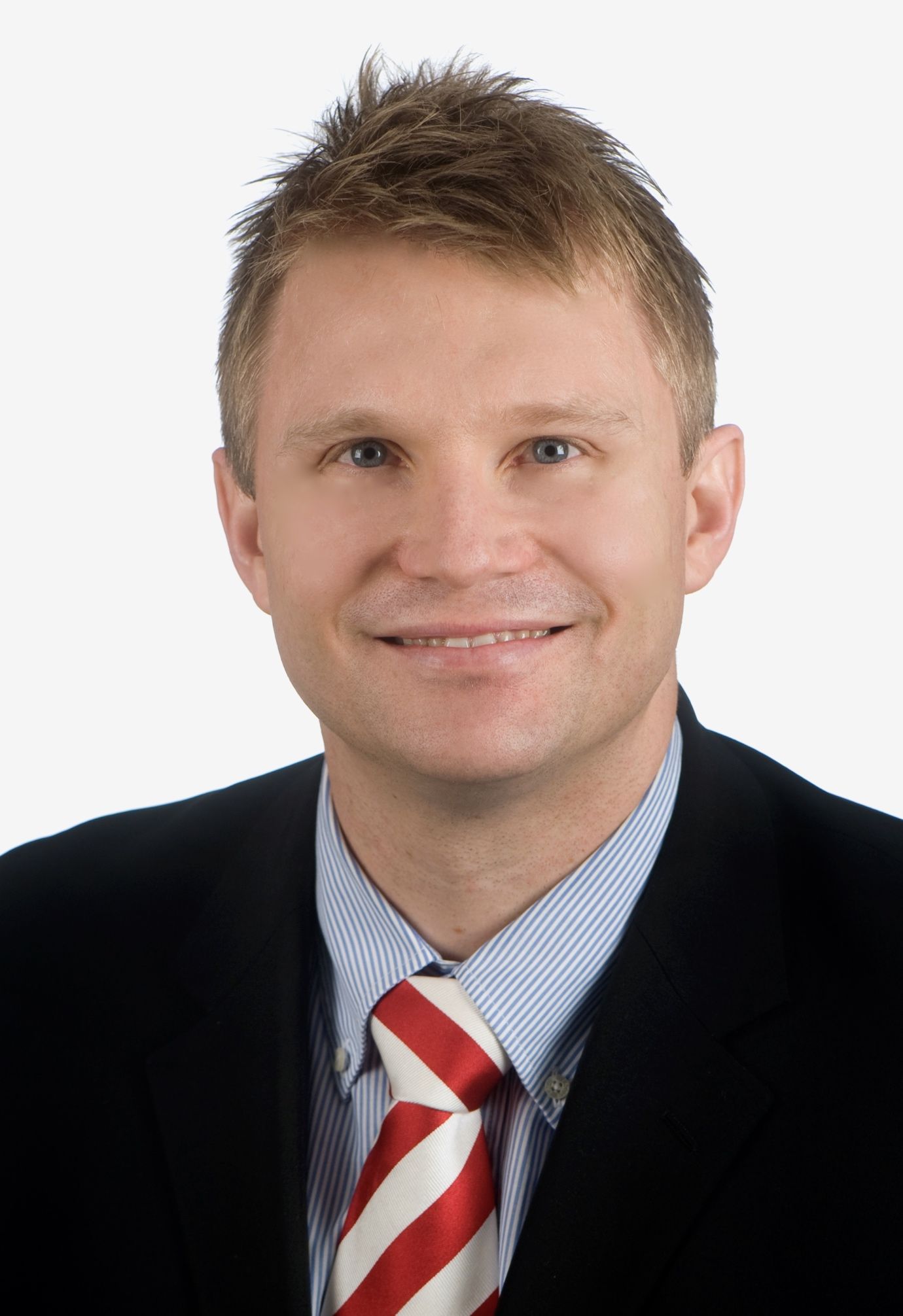 laser eye surgery perth