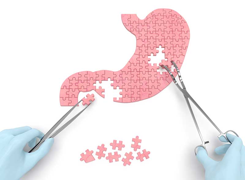 Dr. Federico Víctor Vorrath  - médico gastroenterólogo