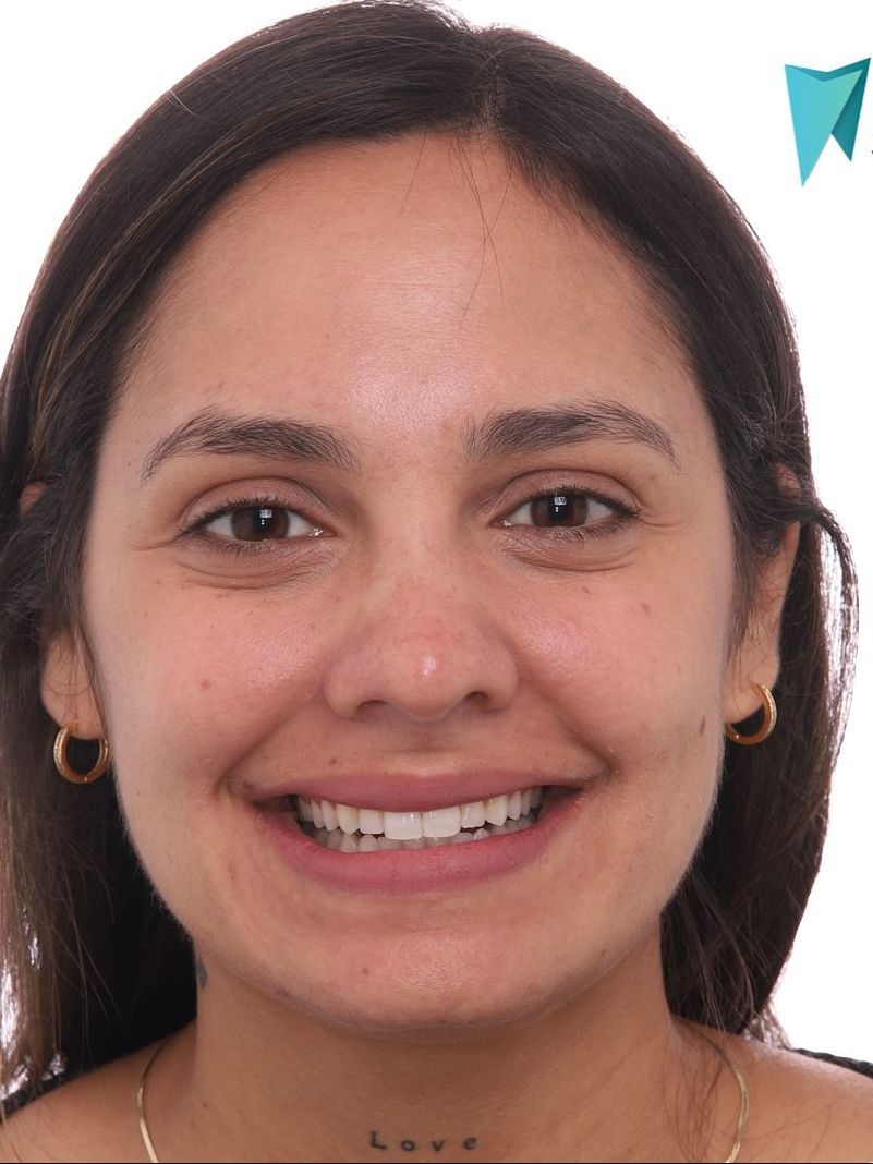 A close up of a woman 's face with a smile on her face