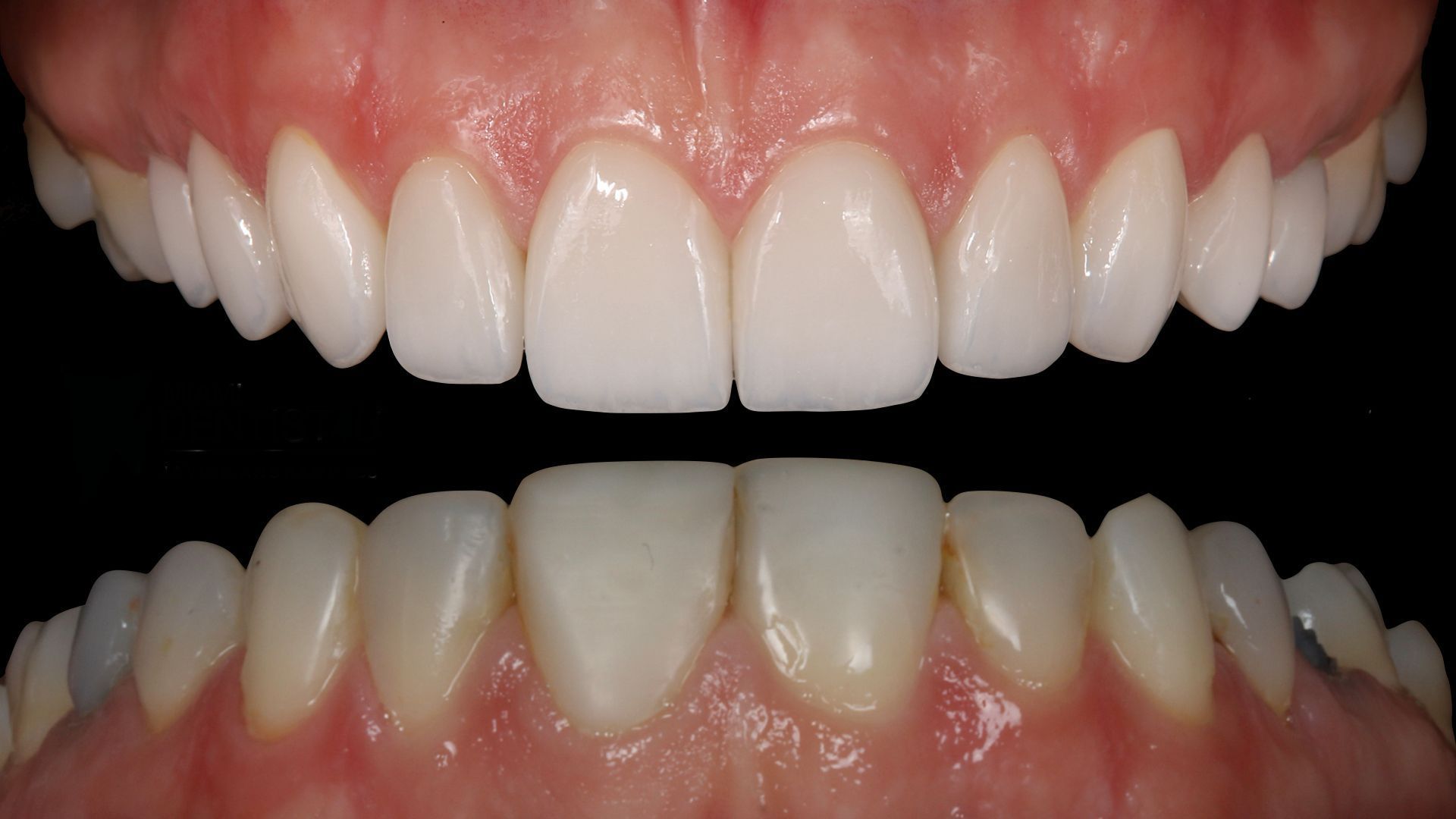 A close up of a person 's teeth with a black background.