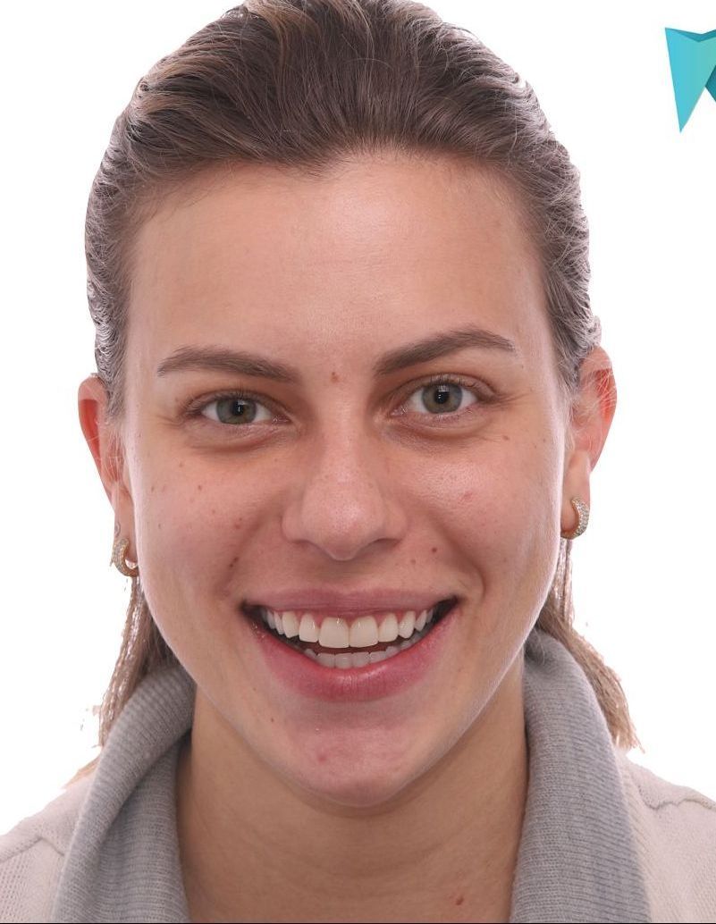 A close up of a woman 's face with a smile on her face