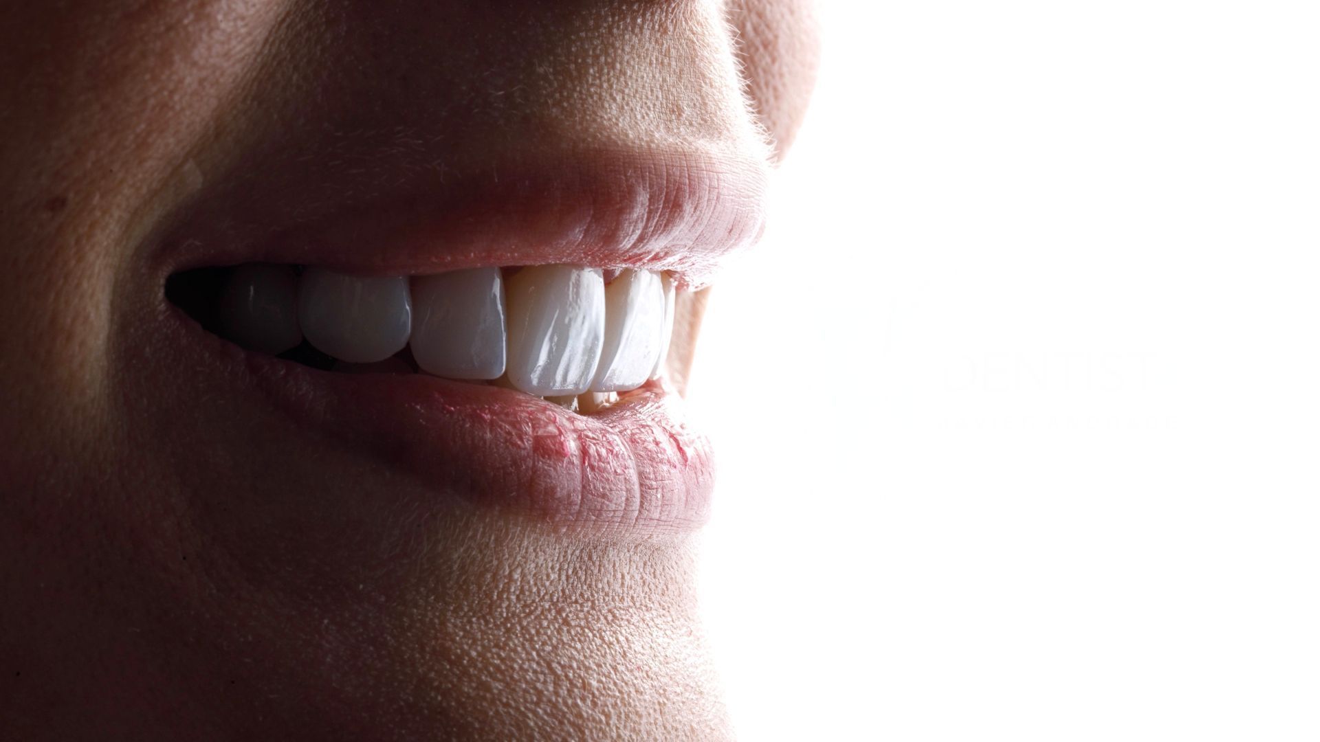 A close up of a woman 's mouth with her teeth showing.
