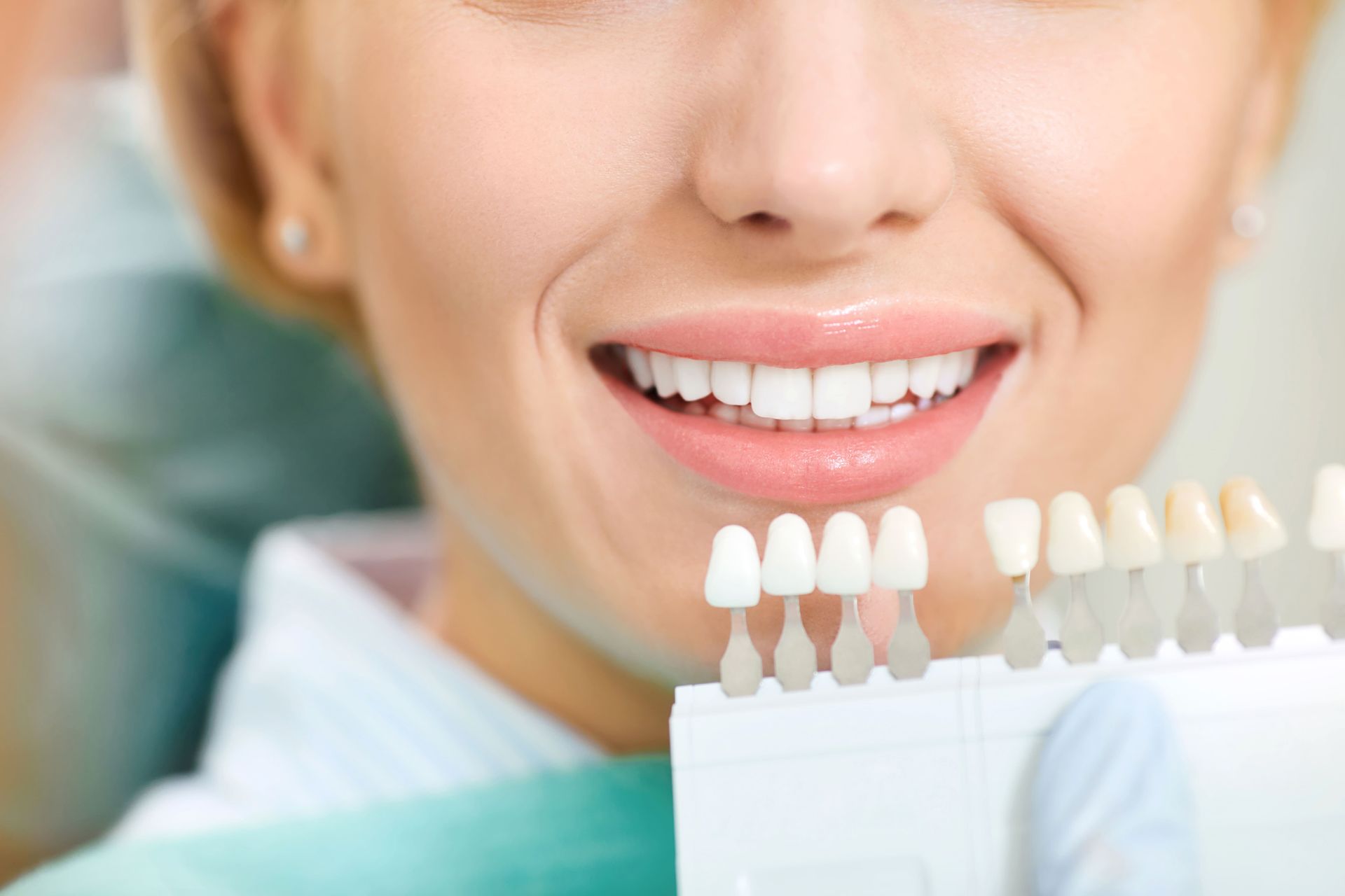 Mulher sorrindo com amostras de tonalidades de dentes; consultório odontológico.