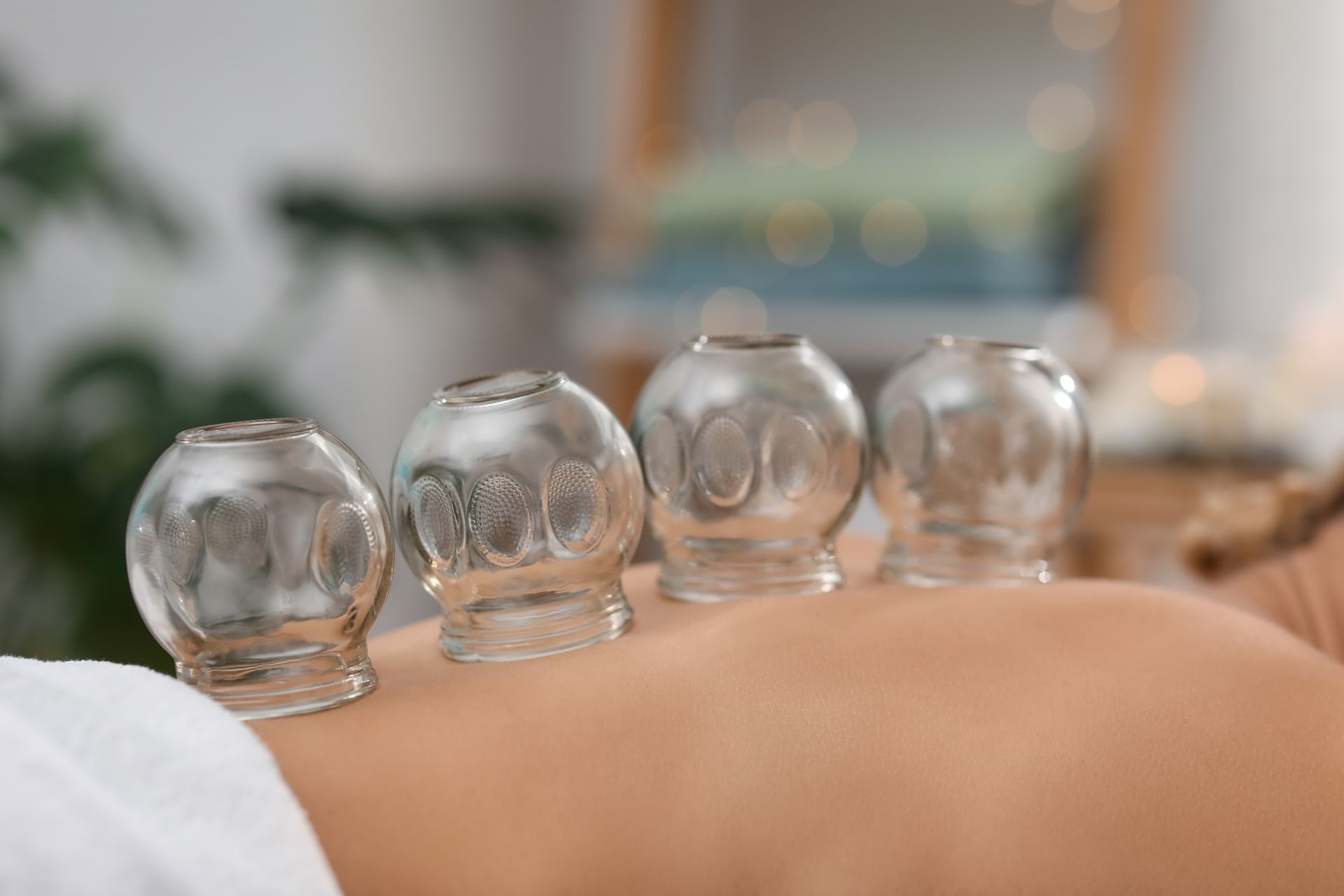 Glass cups on a person's back during cupping therapy; close-up view.