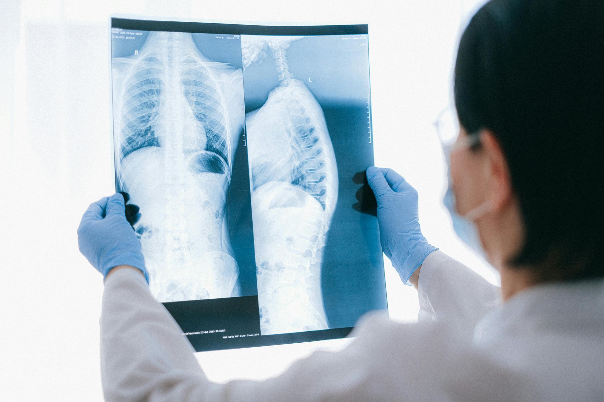 Doctor holding an X-ray of lungs and pointing at the scan in a bright medical office