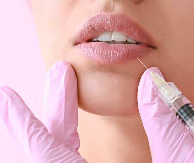 Lip Enhancement 