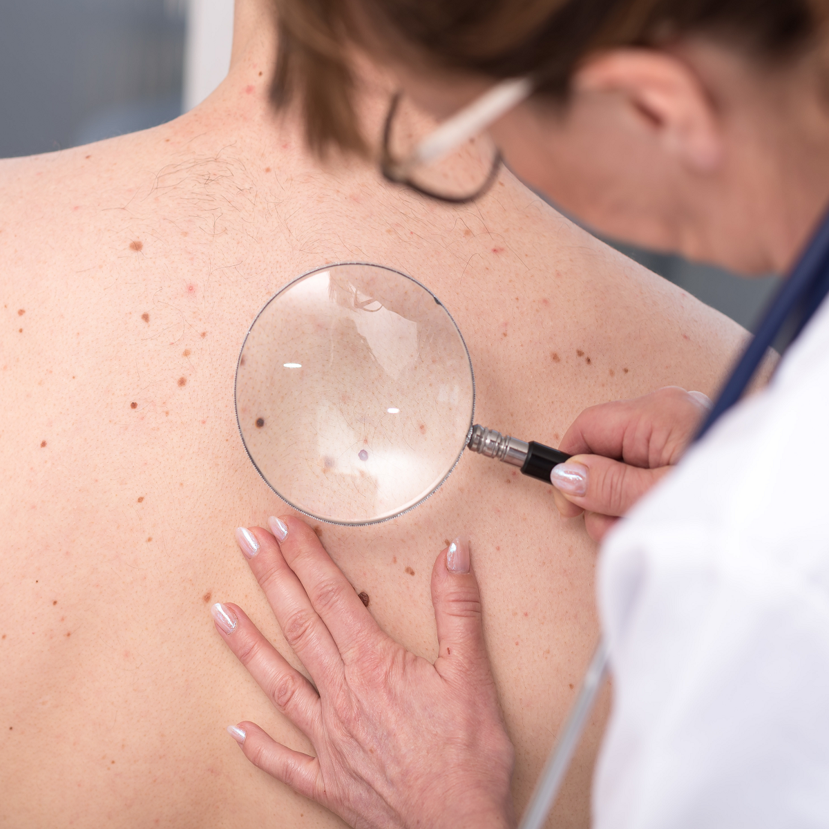 A doctor examines a patient 's back with a magnifying glass