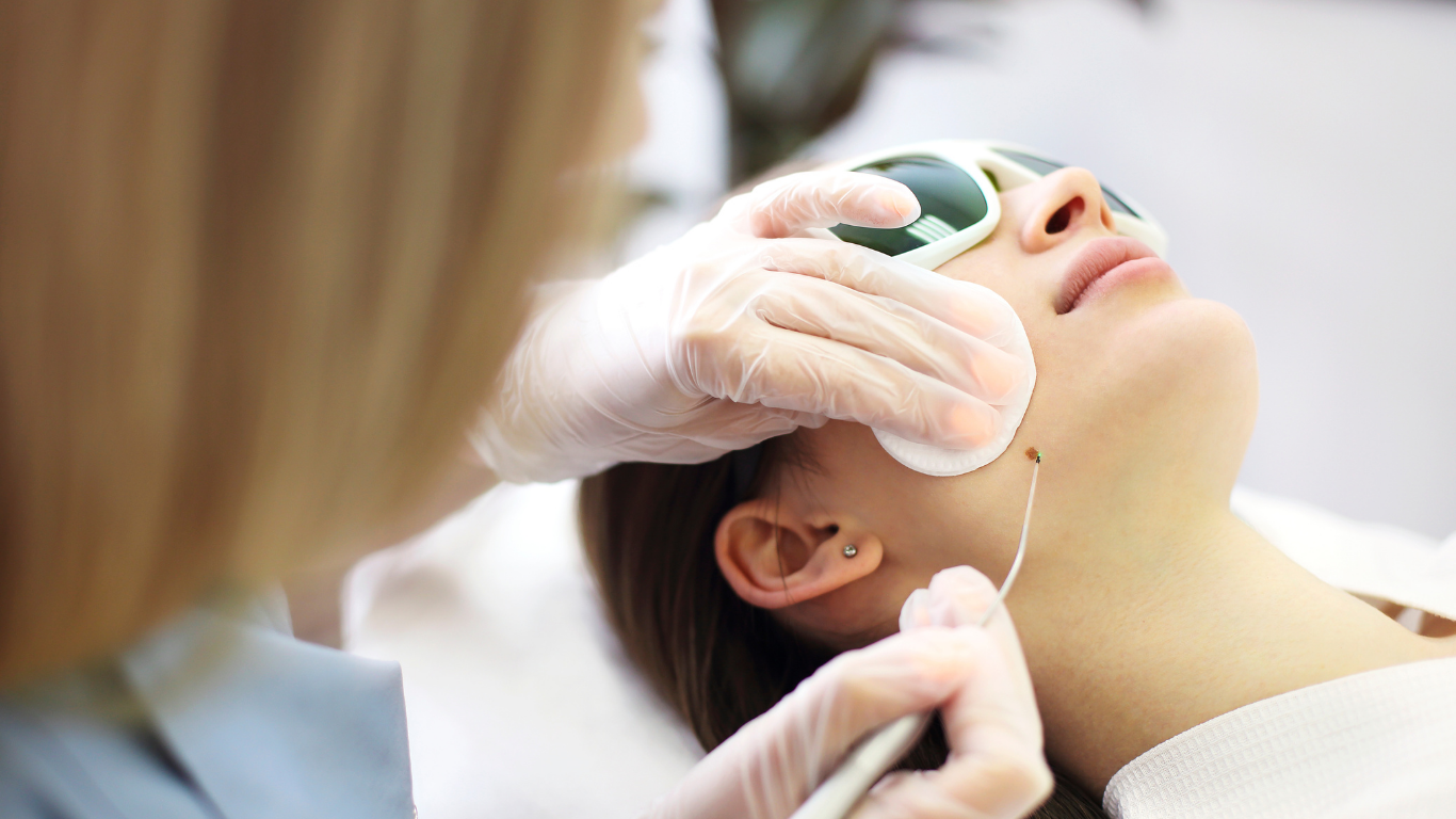 Woman receiving skin treatment near cheek, with protective eye gear.