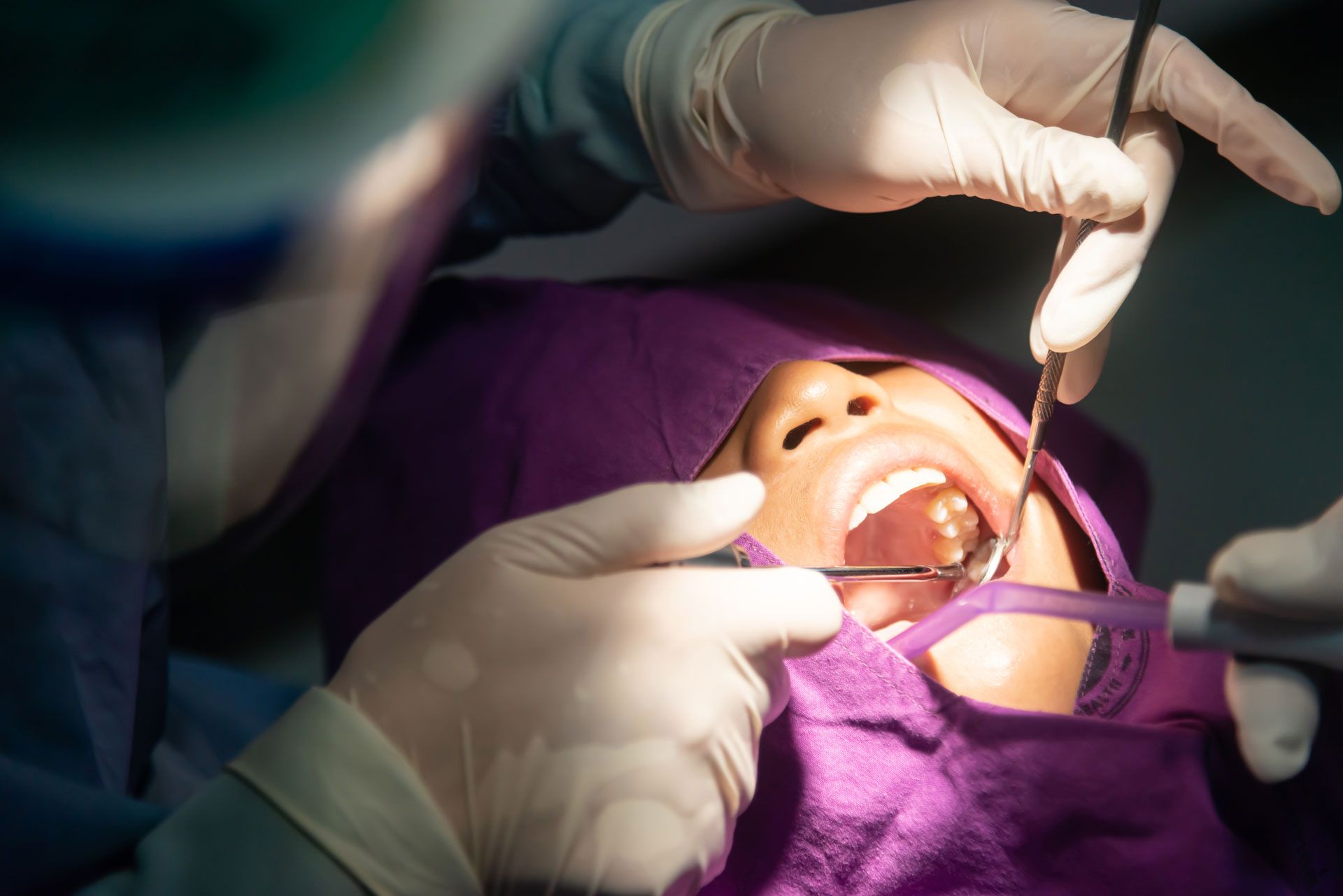 Extractions | Xtracare Dental