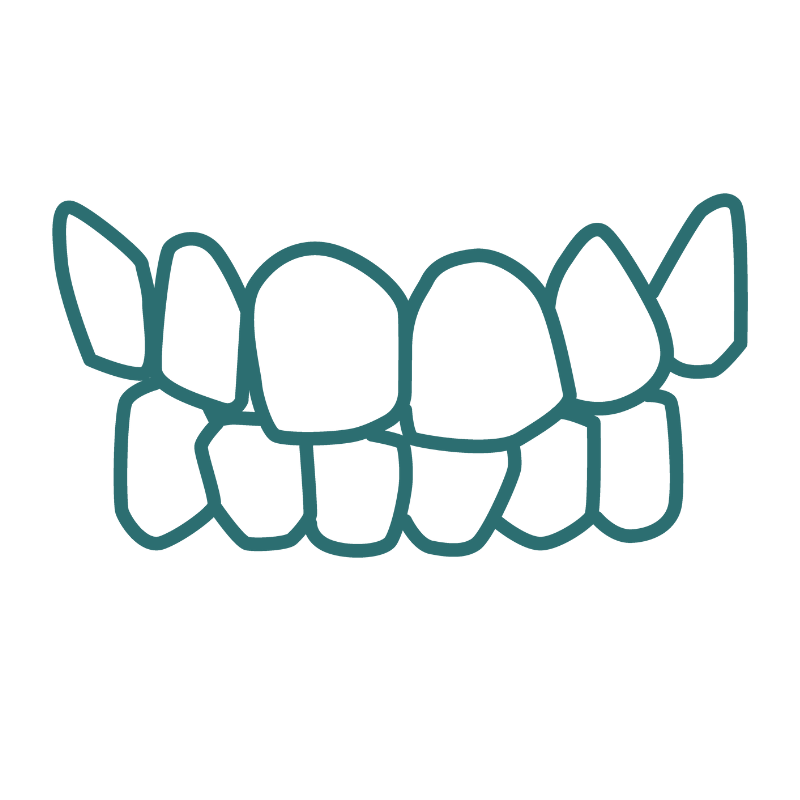 A line drawing of a set of crooked teeth on a white background.
