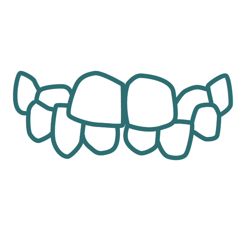 A line drawing of a set of teeth with cross bite on a white background