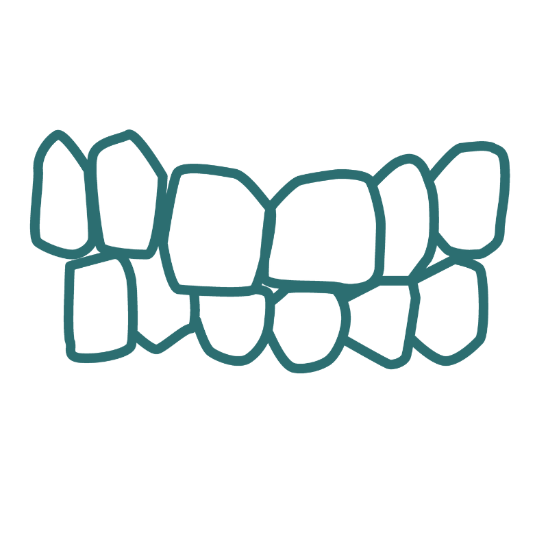 A drawing of a set of teeth crowded on a white background.