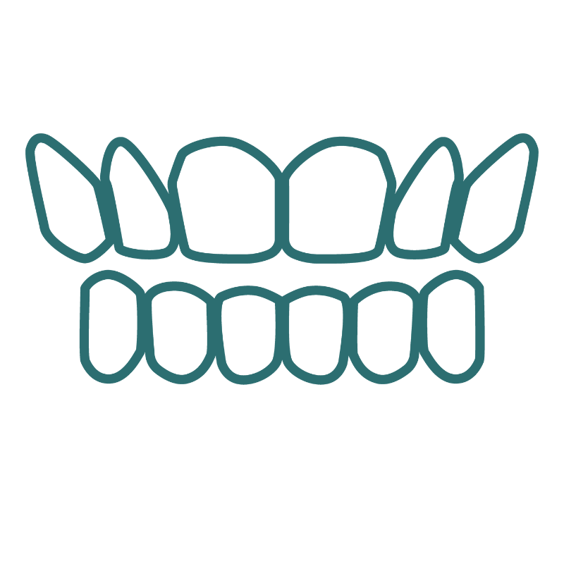 A line drawing of a pair of teeth with openbite on a white background.