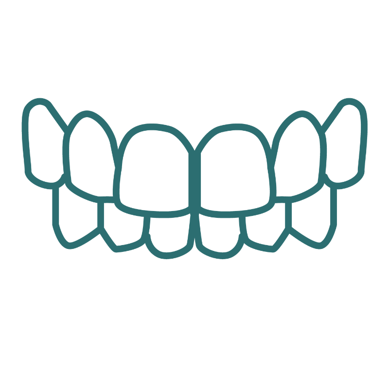 A line drawing of a set of teeth with an overbite on a white background.