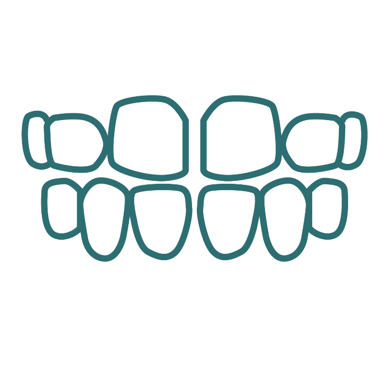 A line drawing of a pair of teeth with spacing between each on a white background.