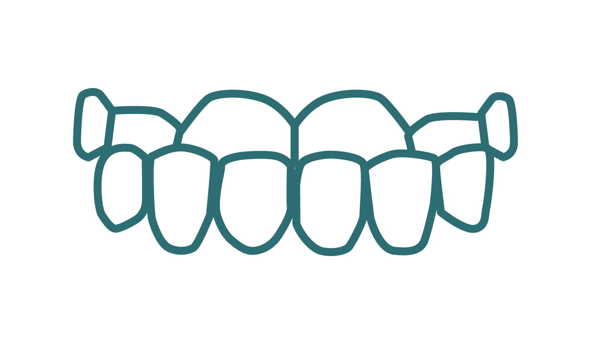 A line drawing of a set of teeth with an underbite on a white background.