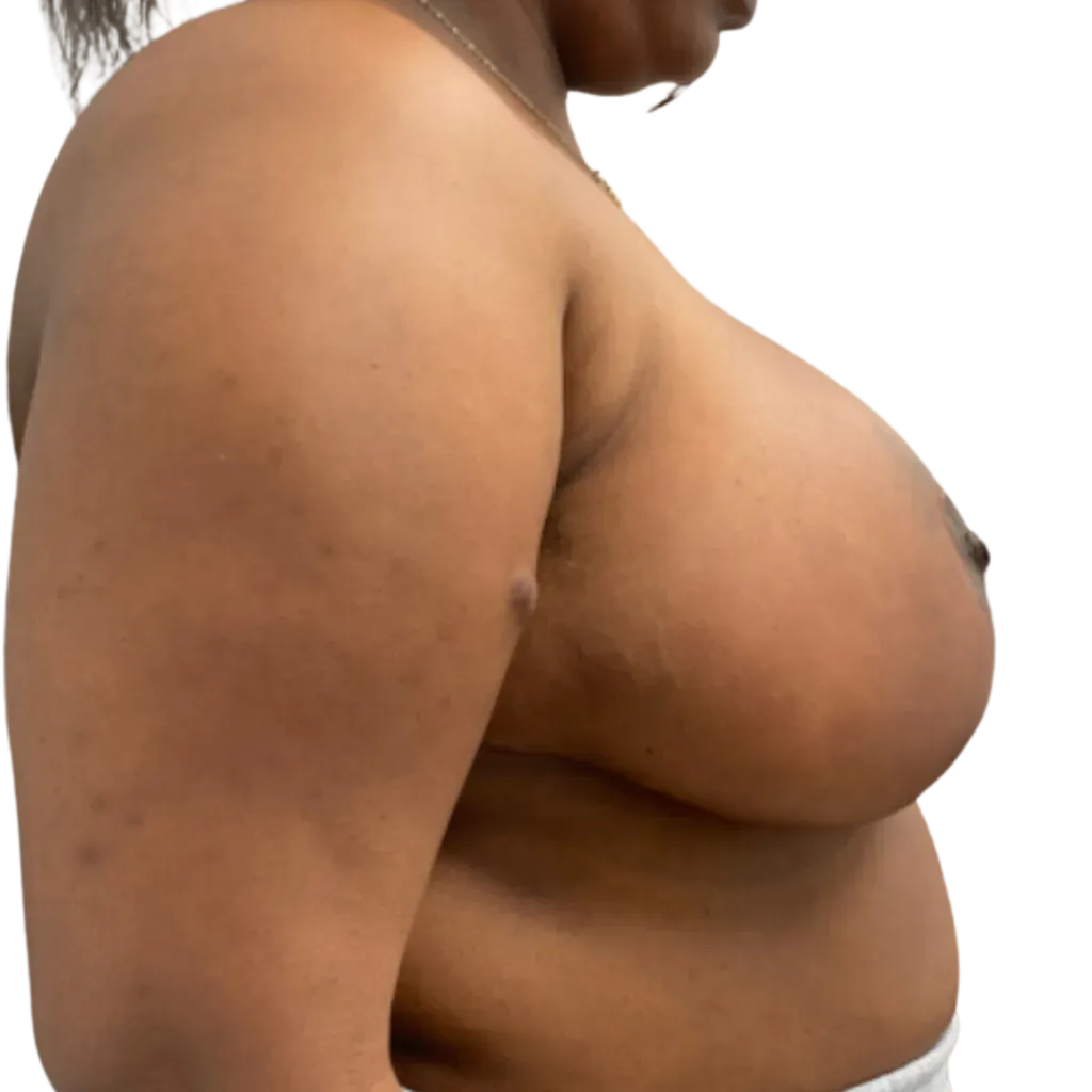 Side view of a person’s torso in a white top against a plain white background