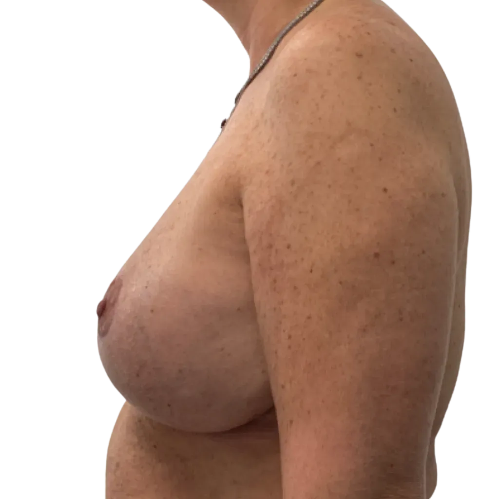 Side view of a bare-chested adult torso against a plain white background