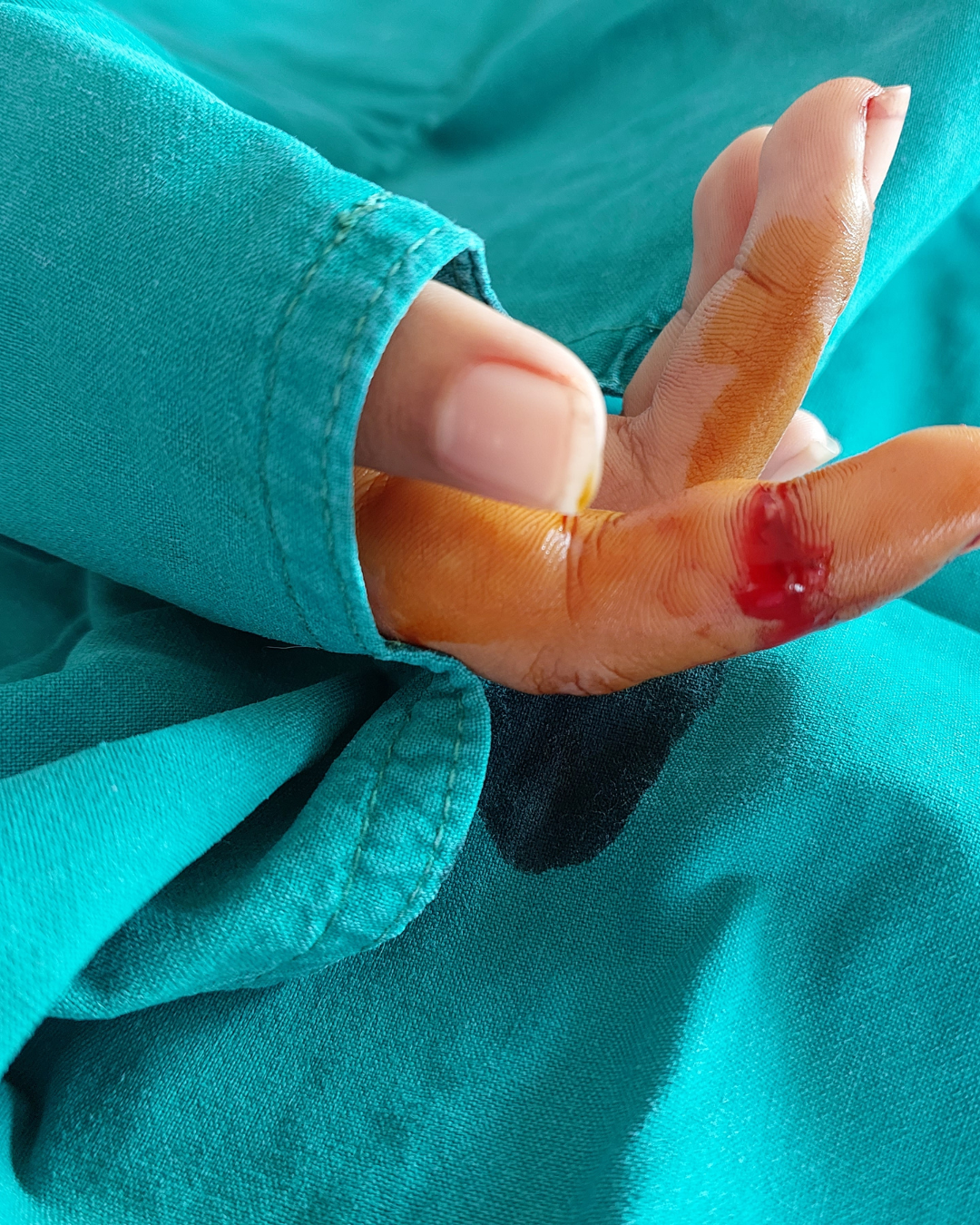 Bandaged finger with a small cut, held against teal fabric.