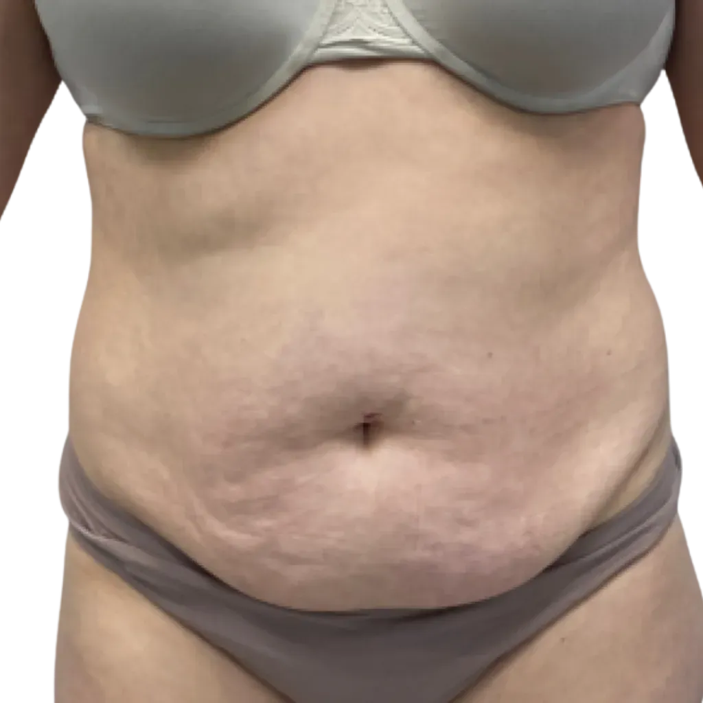 Close-up of a torso in gray underwear, showing a bare abdomen against a white background