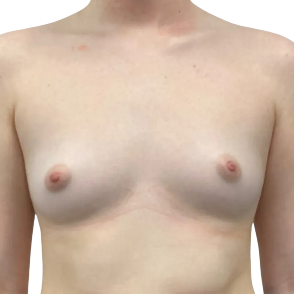 Bare upper torso with chest and shoulders against a plain light background