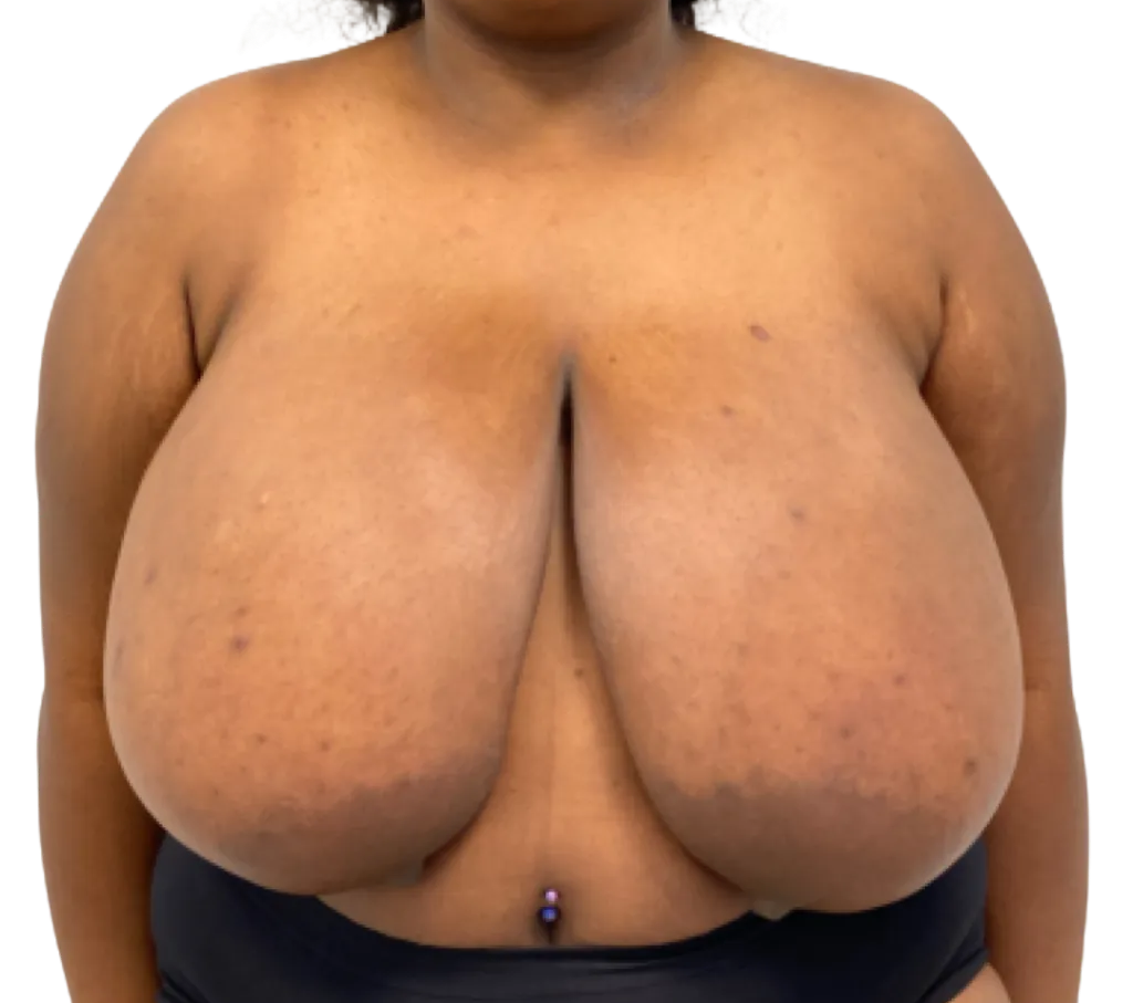 Person’s torso with bare chest and black clothing, front-facing against a plain background