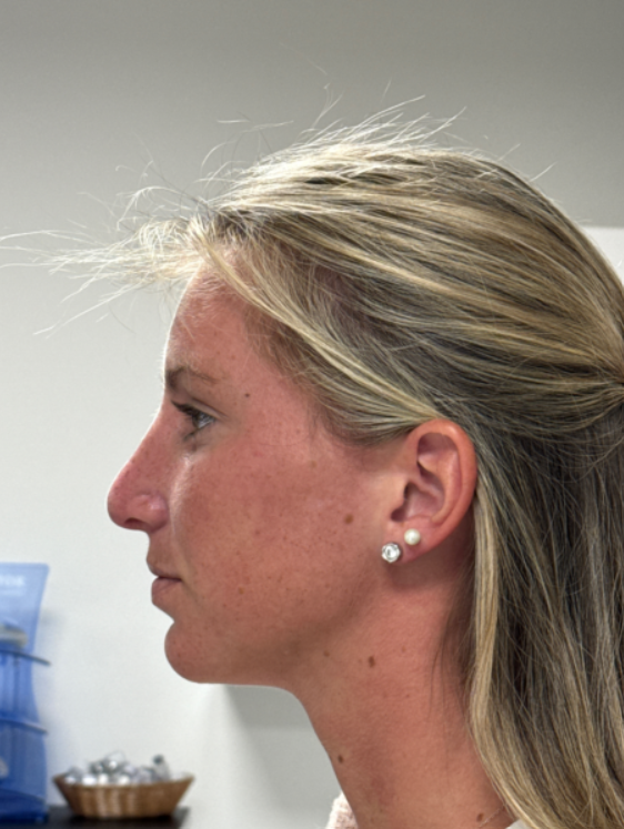 Side profile of a person with dark hair and a beige shirt against a white background