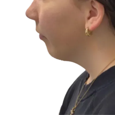 Side profile of a person wearing a black shirt and gold earring against a white background