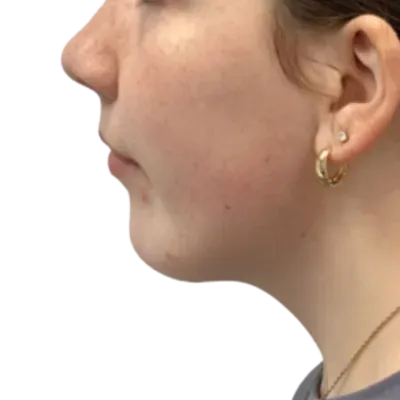 Side-profile close-up of a person’s face with a gold hoop earring against a white background