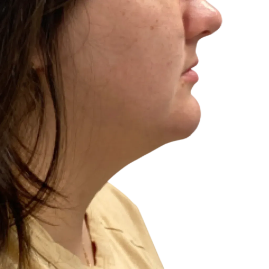 Side profile of a person with dark hair and a beige shirt against a white background