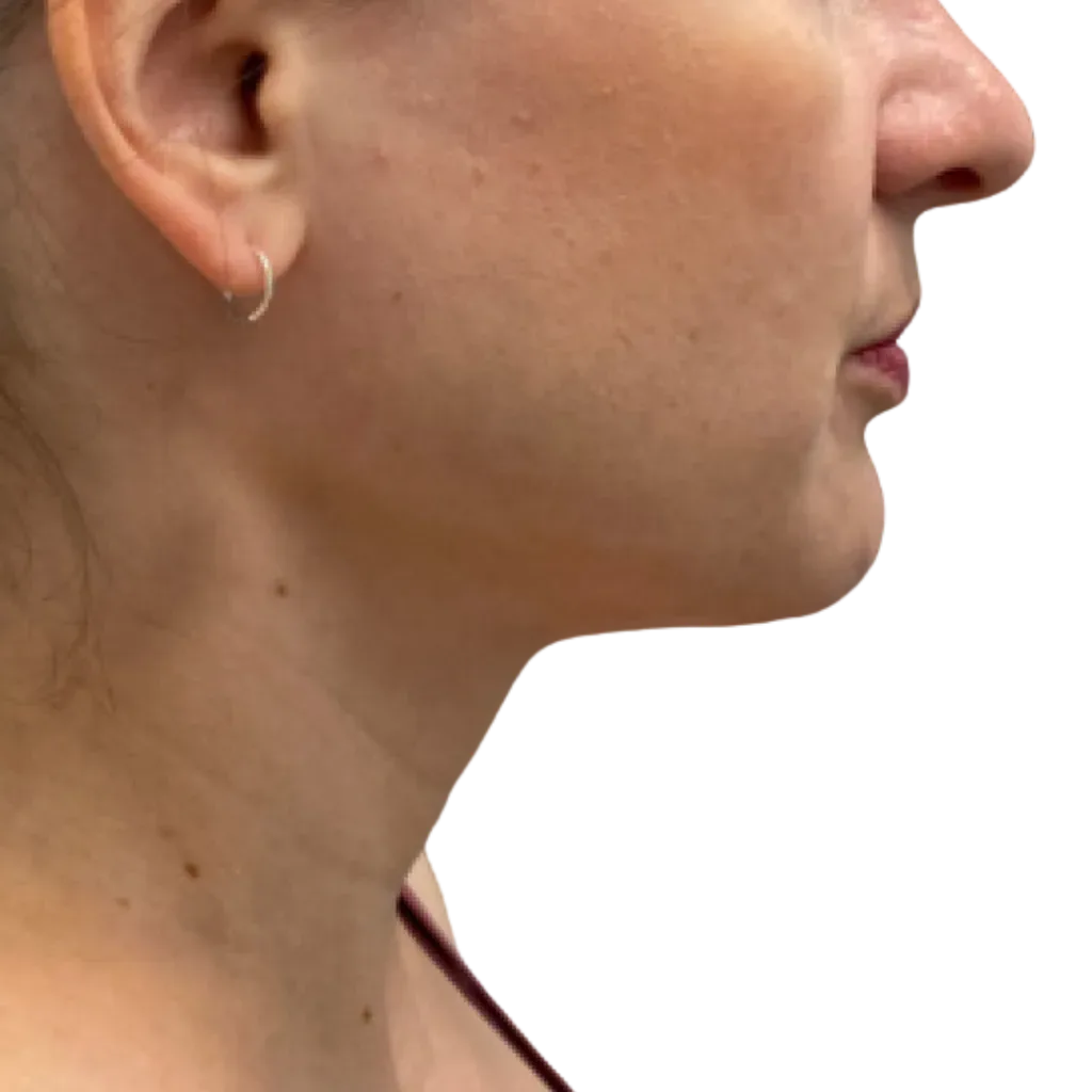 Side profile of a person’s face and neck, wearing a small hoop earring, against a white background