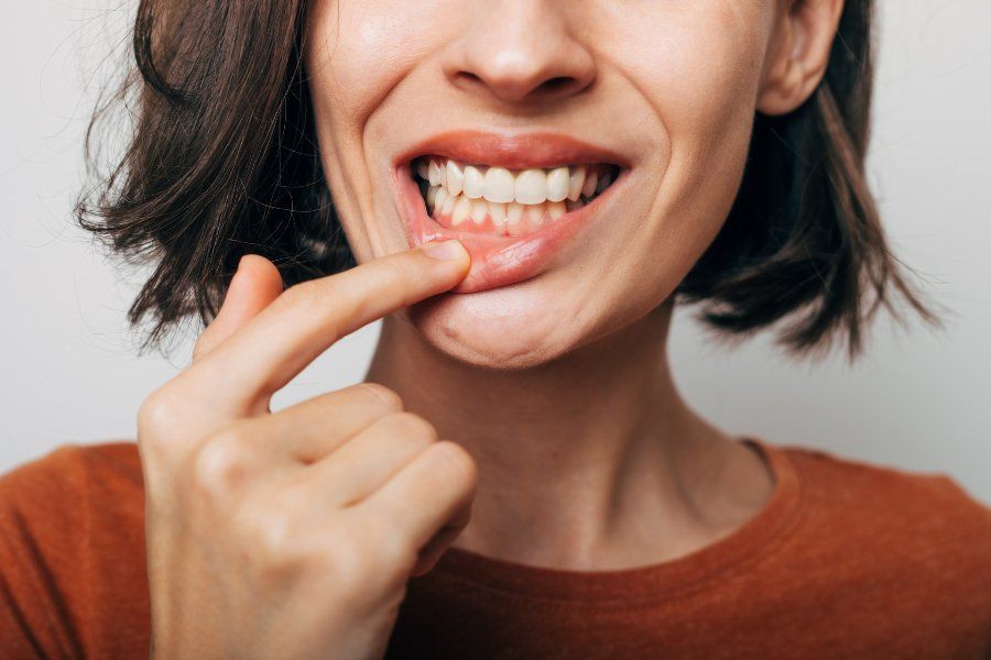 Woman pointing at her teeth, smiling.