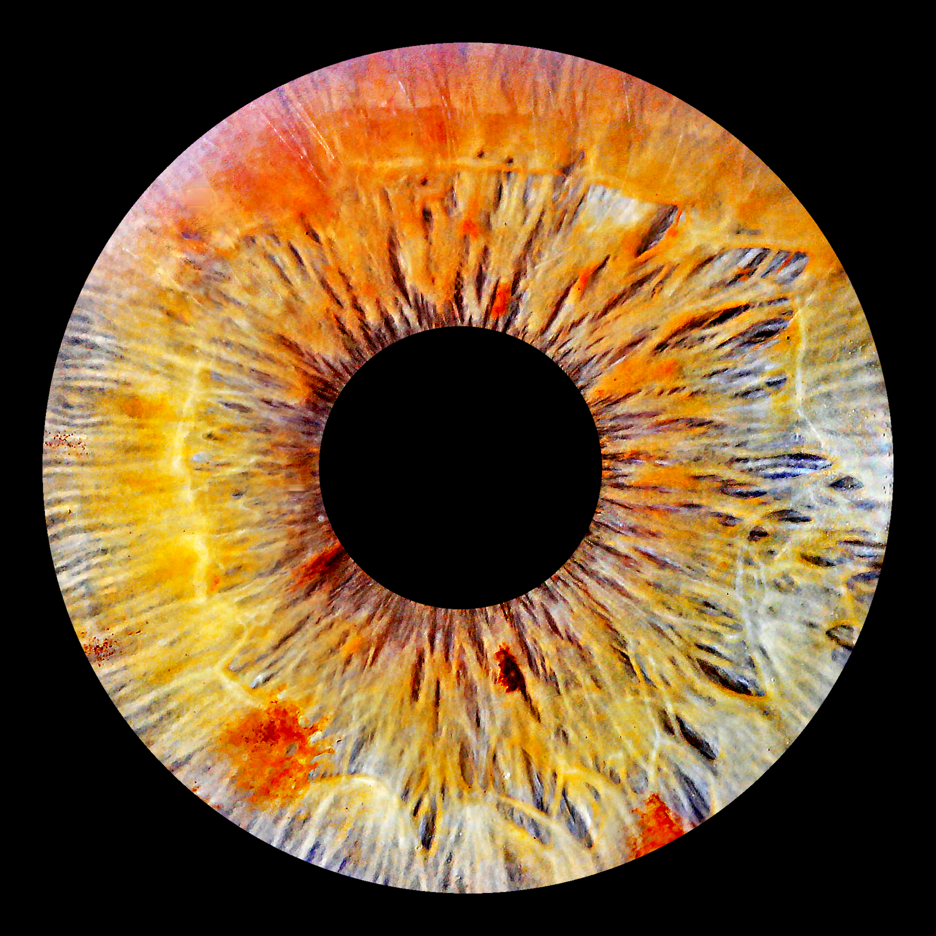 Irisfoto LDL