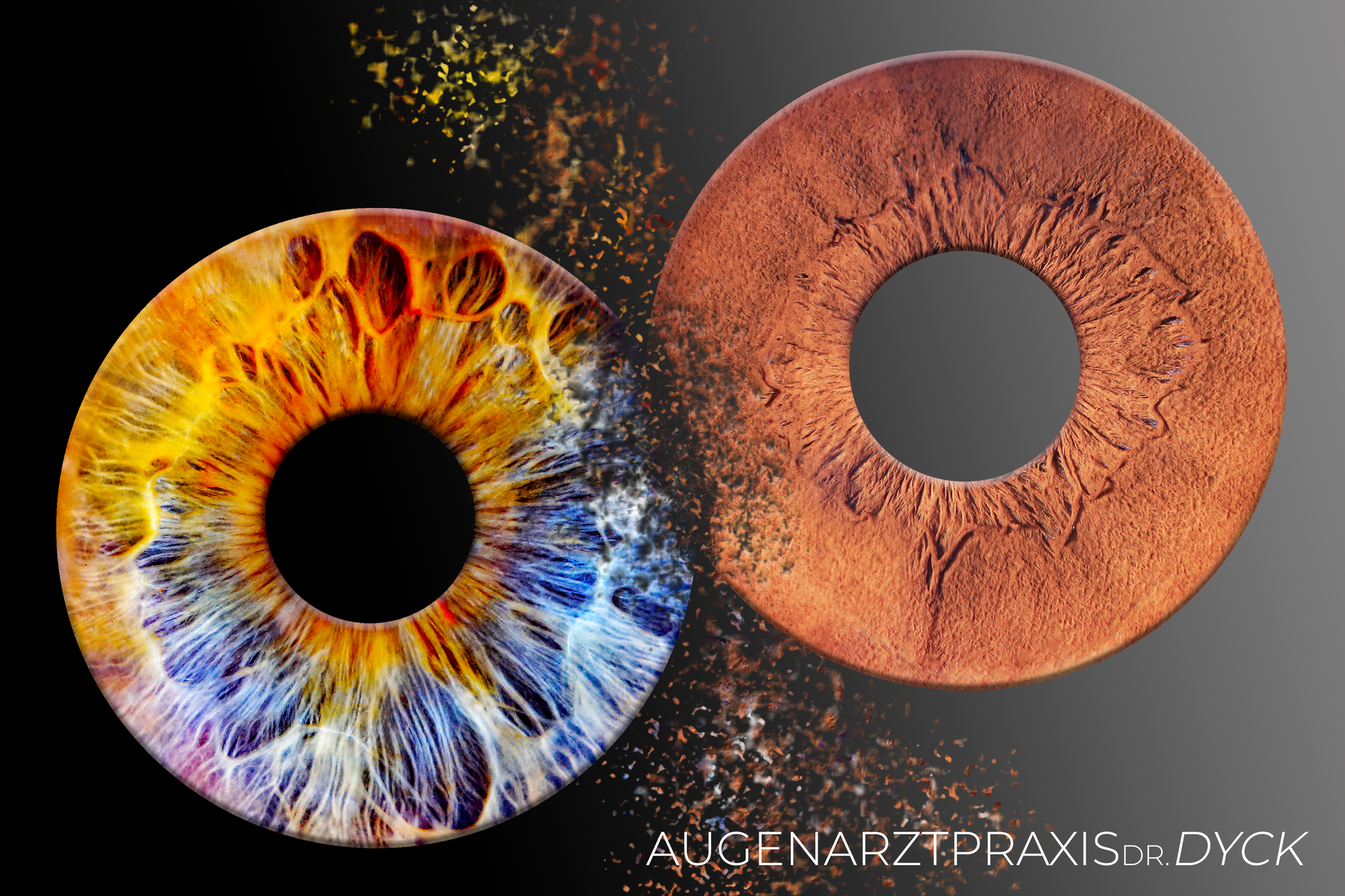 Irisexplosion