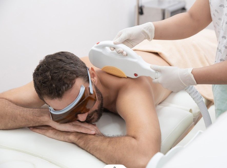 The Tattoo Removal Clinic performing laser hair removal for men