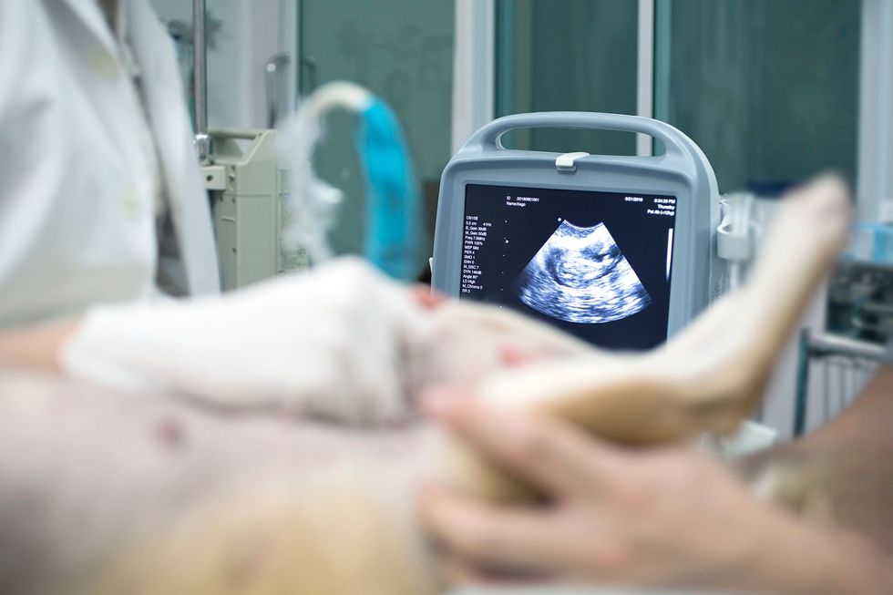 Ecografia in corso, con l'immagine fetale visualizzata su un monitor accanto alla paziente in una stanza d'ospedale.