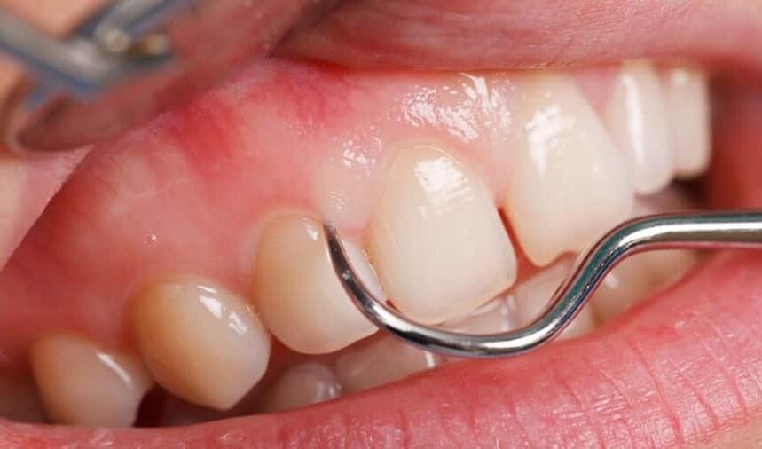 DRA. MA. PATRICIA GONZÁLEZ DÍAZ-periodoncia