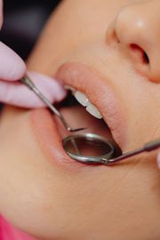 Dental tools in a mouth during an exam. Pink gloved hands hold a mirror and pick.