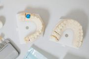 Two dental molds on a white surface, one with a blue accent.