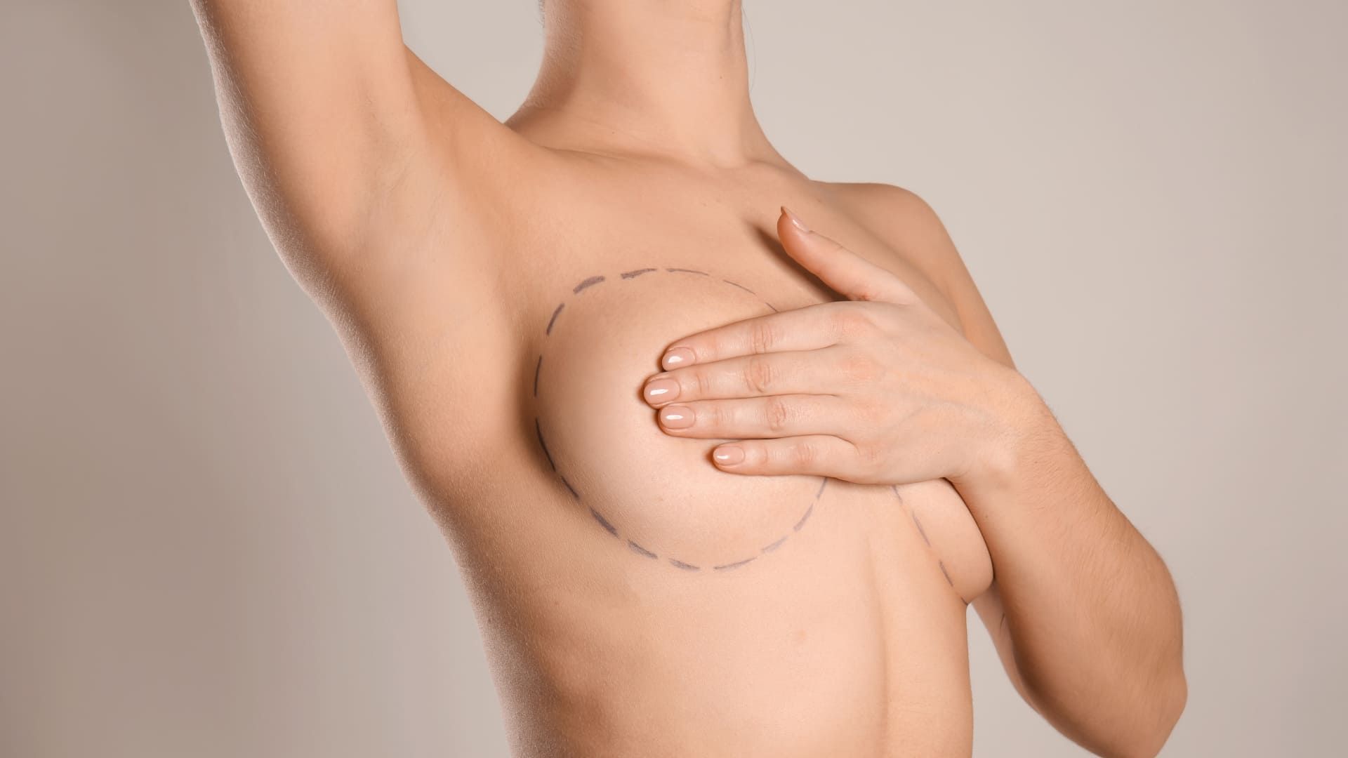 Breast Plastic Surgery.