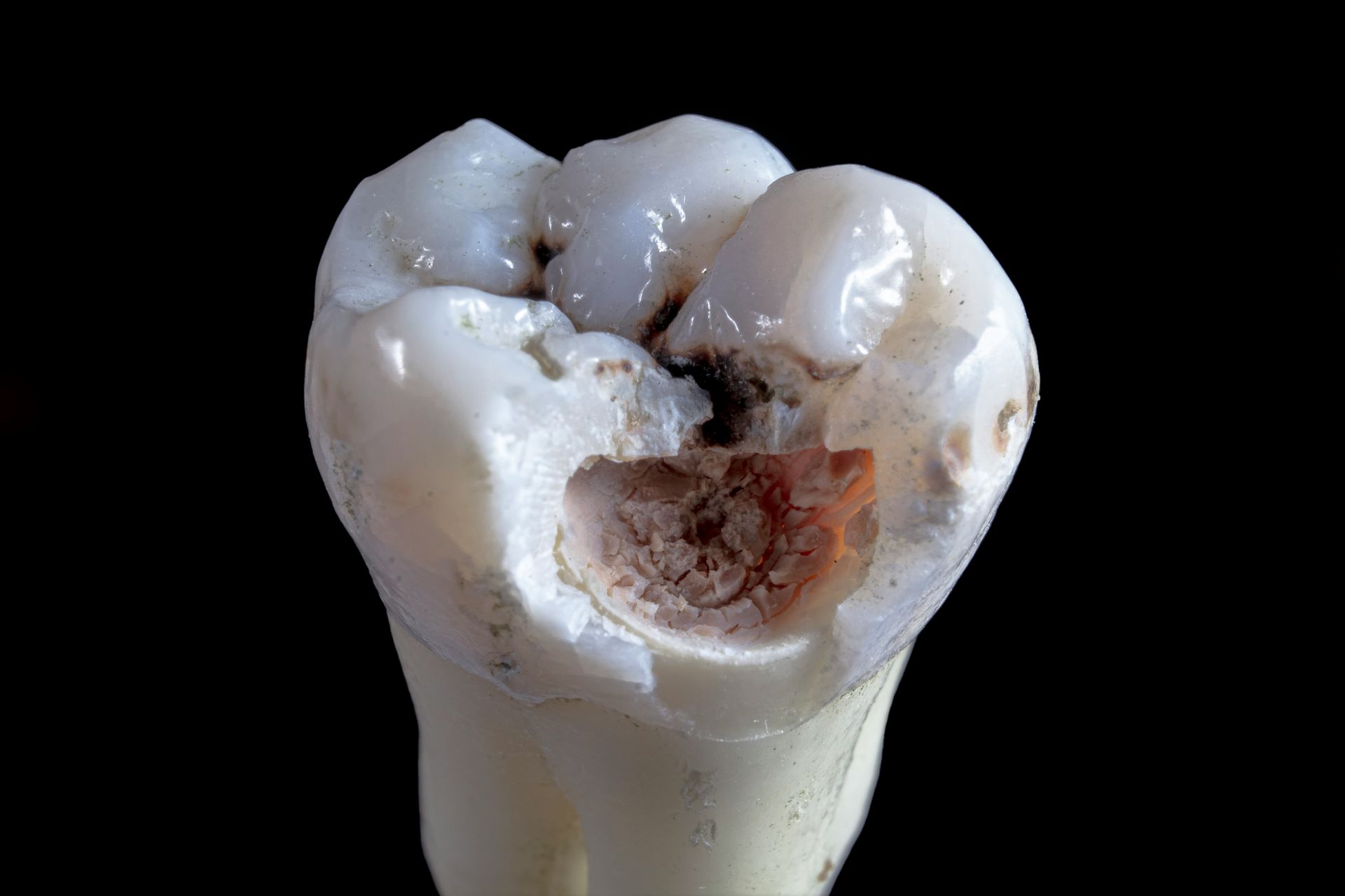 A close up of a tooth with a hole in it on a black background.