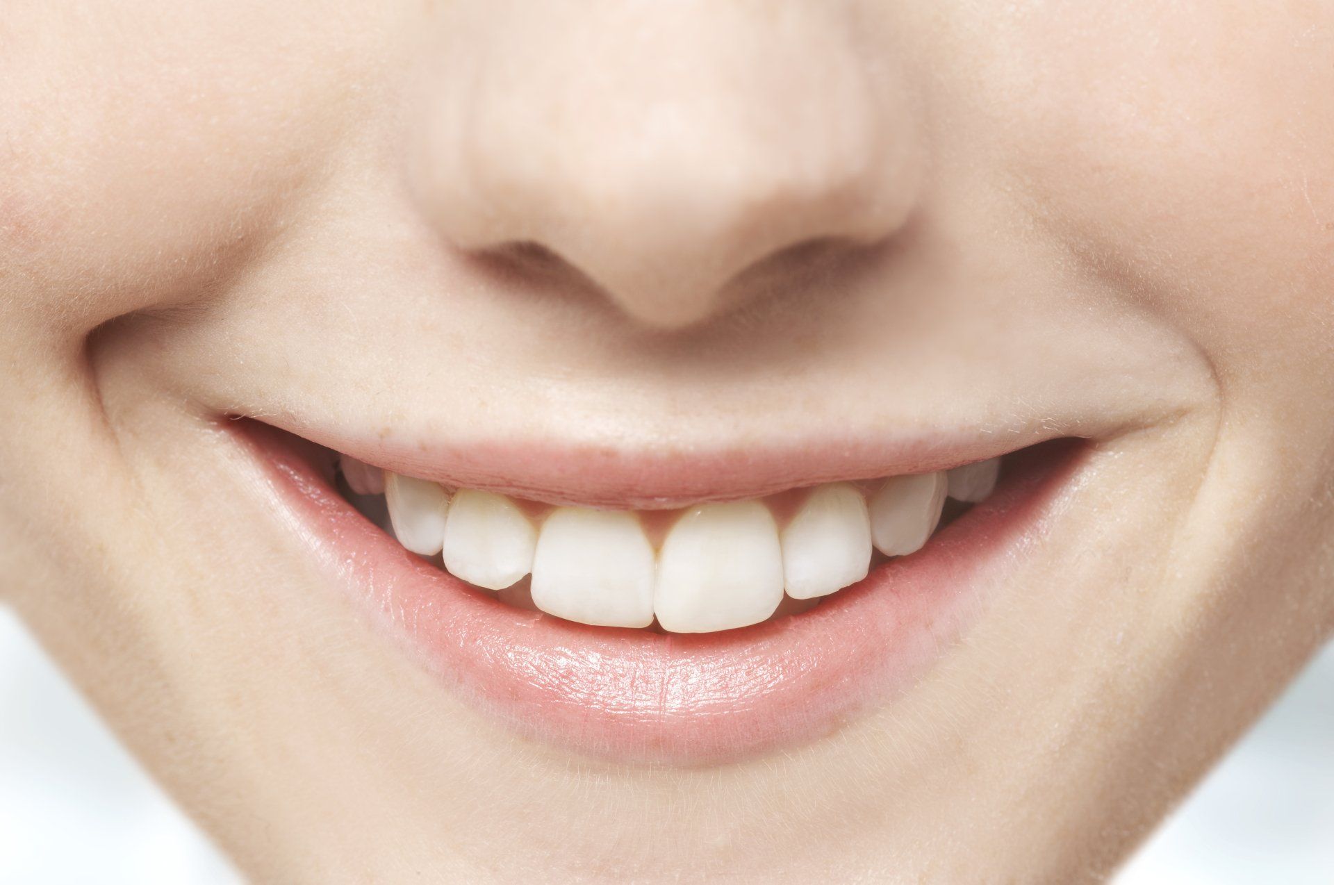Sbiancamento dentale