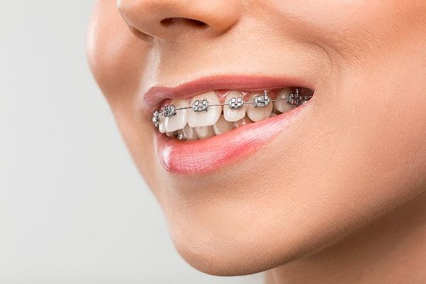 visita dentistica